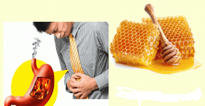 فروش عسل گون